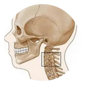Cervical Neuroplasty